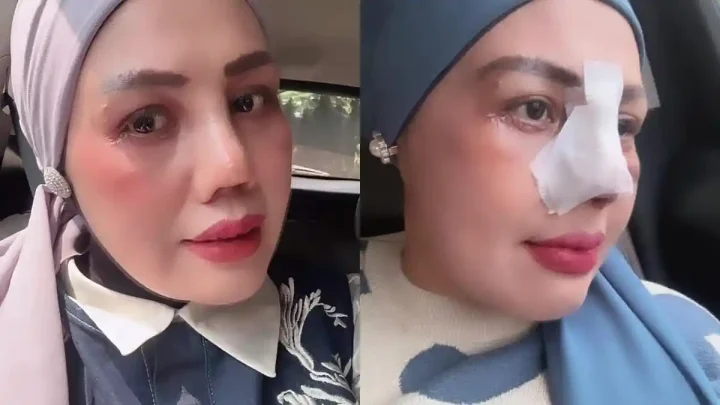 Important Visit: Usai Operasi Plastik, Elly Sugigi Pede Wajahnya Mirip Irish Bella, Siap Incar Pria Ganteng Lagi?