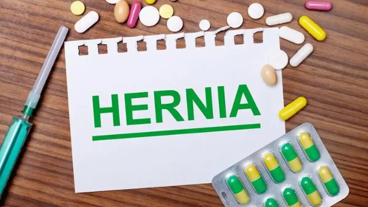 ilustrasi-hernia-3
